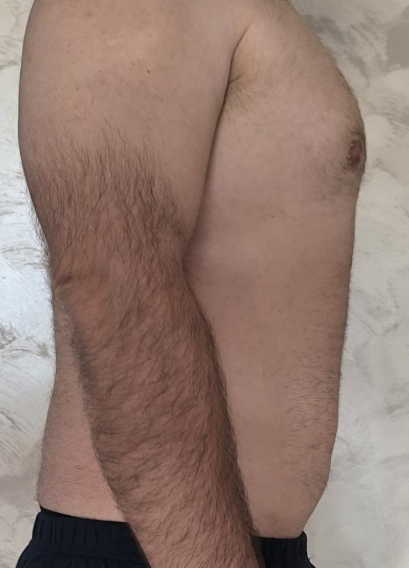 Klijent posle transformacije, 104 kg