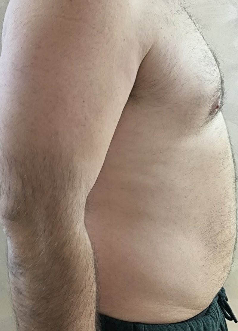 Klijent pre transformacije, 123 kg